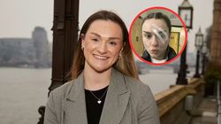 23-latka doznała udaru na wakacjach. Mówi, jaki był jedyny objaw