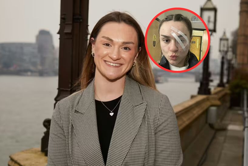 23-latka doznała udaru na wakacjach. Mówi, jaki był jedyny objaw