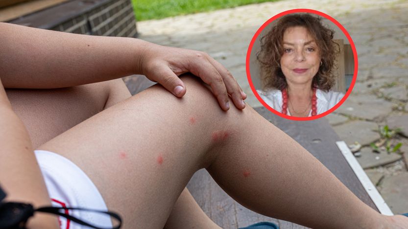 Zaczyna się od ukąszenia. Choroba powoduje gorączkę i silne bóle stawów