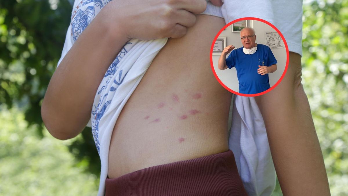 Przez nadużywanie antybiotyków mamy problem z superbakteriami