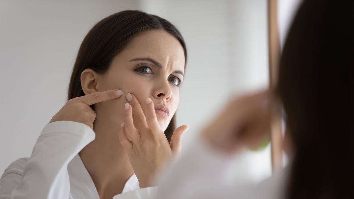 Wyciskanie wągrów grozi wystąpieniem nieestetycznych blizn i przebarwień.