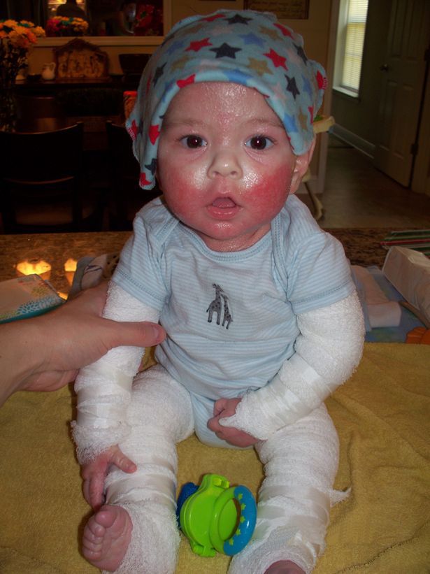 Lekarze nie pomogli jej synkowi. Matka wymyśliła sama sposób na zwalczenie choroby