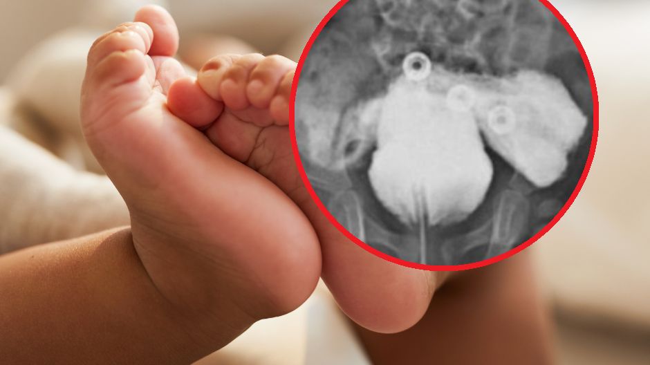 Przypadek 1 na 30 mln