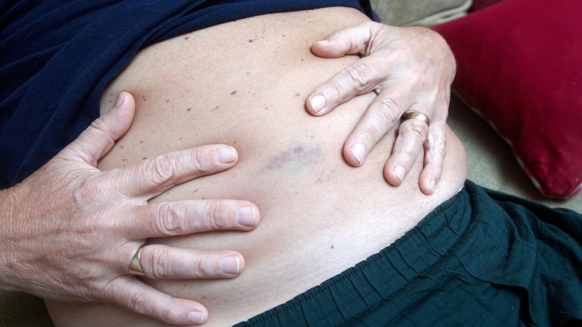 Bieganie maratonów może zwiększać ryzyko raka jelita grubego