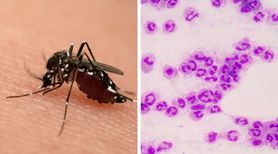 Ugryzienie przez komara doprowadziło do tragedii. 43-letniej kobiecie amputowano ręce i nogi