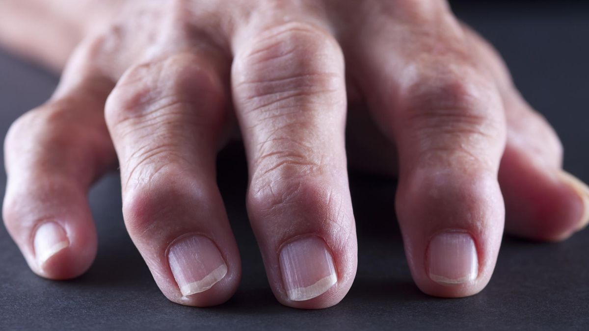 Choroby autoimmunoloiczne są trudne w diagnozie