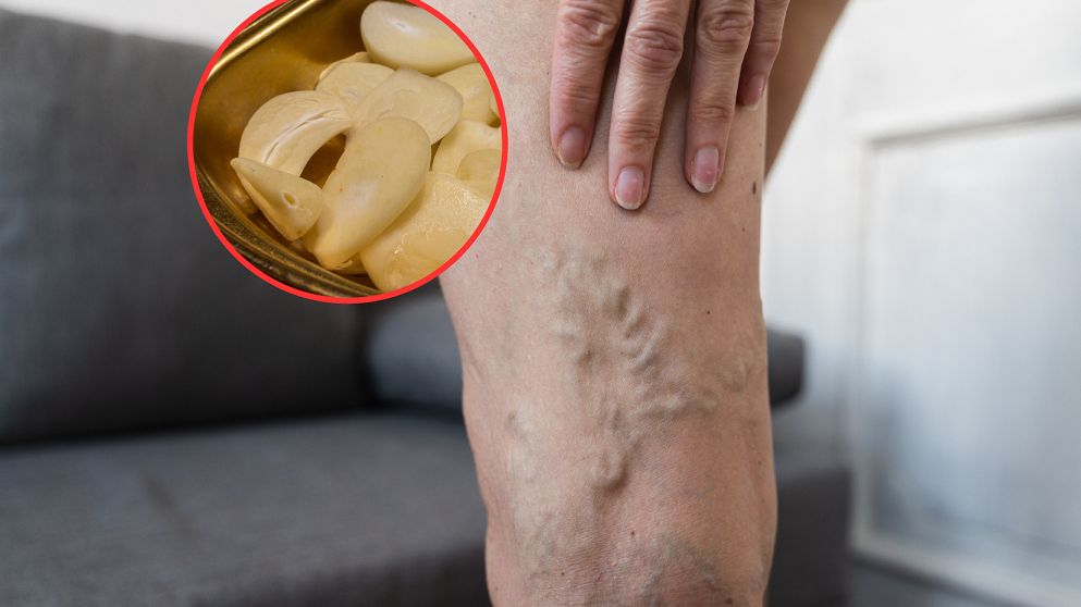 Produkty, które wspierają układ krążenia. Jedz codziennie, by unikać zakrzepów