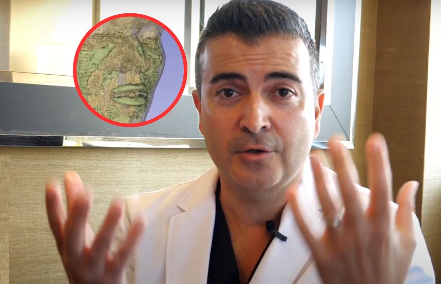 Chirurg pokazał twarz z wypełniaczami. Nagranie z rezonansu przeraża