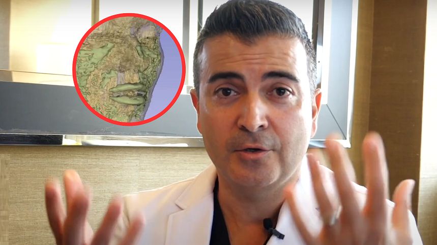 Regularnie stosowała wypełniacze do twarzy. Taki jest skutek