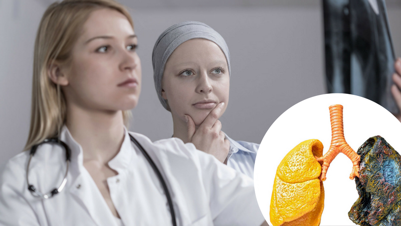 Przełom w leczeniu raka? Rewolucyjny nowy lek DWUKROTNIE efektywniejszy w leczeniu raka piersi, płuc oraz prostaty