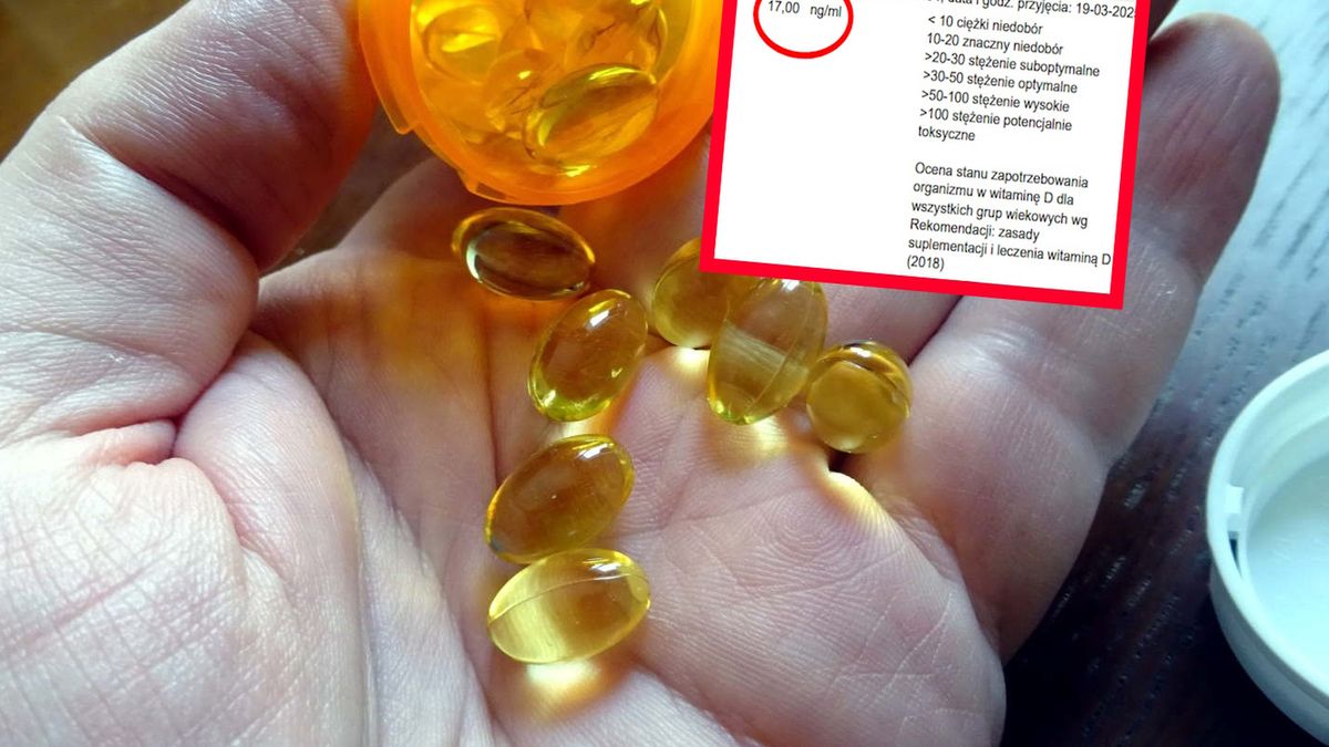 Powszechny problem Polaków. Pokazała alarmujące wyniki poziomu witaminy D