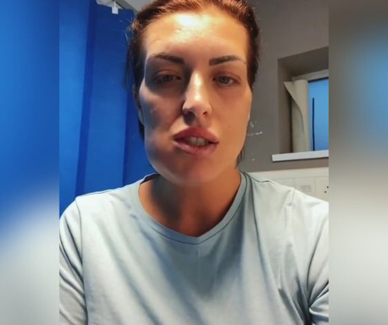Amanda ma zdeformowaną twarz po nieudanej operacji