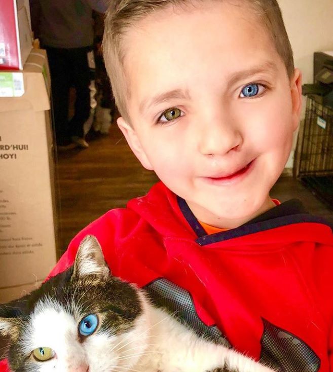 Chłopiec cierpi na heterochromię, czyli dwukolorowość tęczówki