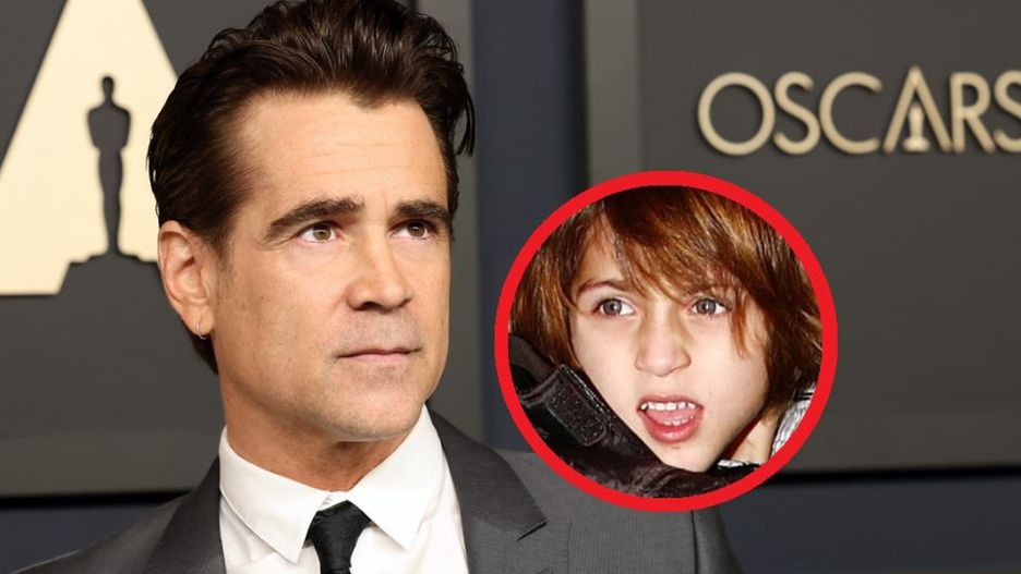 Gdy śmiech oznacza chorobę. Te dzieci nazywane są "radosnymi marionetkami"