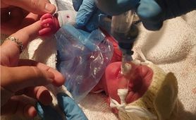 Urodził się zaledwie tydzień po terminie dopuszczającym aborcję