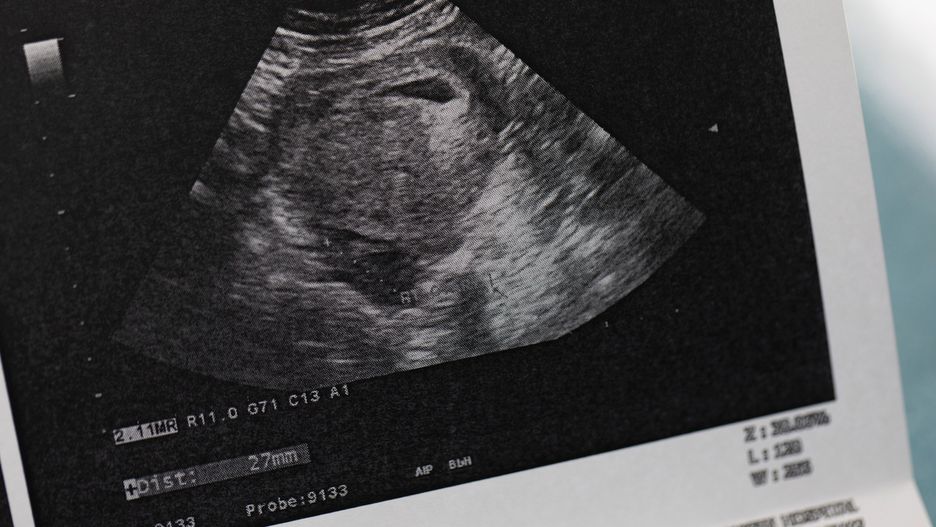 13-latka zaszła w ciążę z 10-latkiem? Zdecyduje badanie DNA