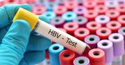 Wirus HBV – czym jest i jakie są objawy zakażenia?