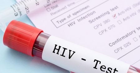 HIV rozprzestrzenia się w Rosji. Ponad milion nosicieli wirusa