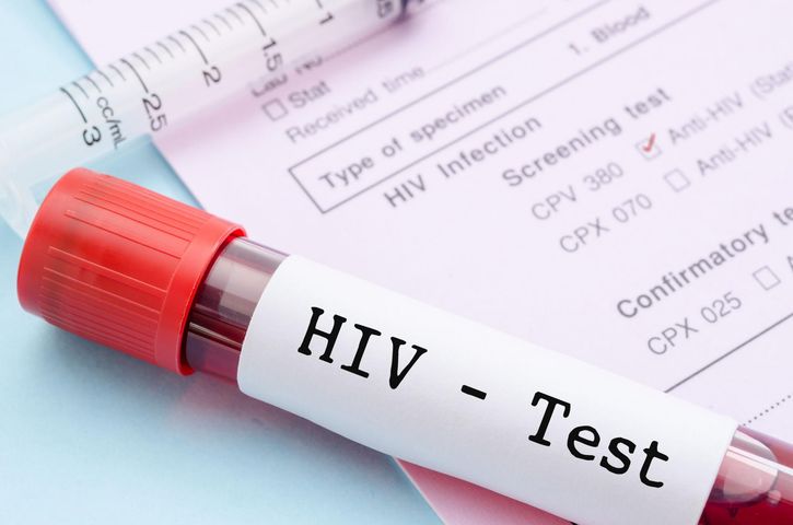 HIV rozprzestrzenia się w Rosji. Ponad milion nosicieli wirusa