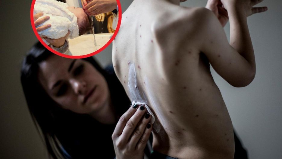 "Ospa party" u znanej na Instagramie mamy