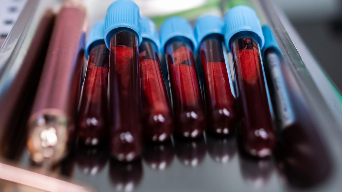 Ile powinno wynosić CRP? Taki poziom może alarmować o raku