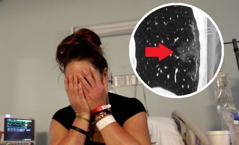 Powikłania po COVID-19. "Ich płuca wyglądają jak bulgocząca zupa". Dr Rasławska o problemach ozdrowieńców