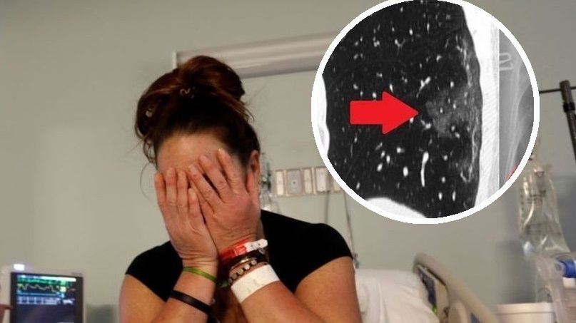 Powikłania po COVID-19. "Ich płuca wyglądają jak bulgocząca zupa". Dr Rasławska o problemach ozdrowieńców