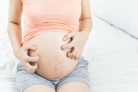 Swędzący brzuch w ciąży: czy to objaw, który powinien niepokoić?