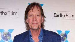 Kevin Sorbo przeszedł trzy udary. Opowiedział o objawach