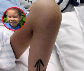 Znaleźli guzek na nodze 8-latka. Diagnoza ich zdruzgotała