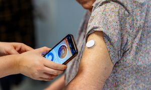 CGM to szansa dla pacjentów z cukrzycą. Nie każdy może korzystać z refundacji