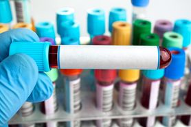Hipertriglicerydemia – przyczyny, objawy i leczenie