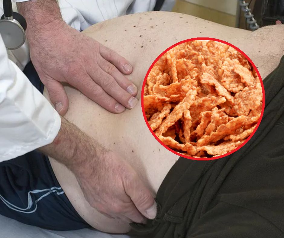 Jadł to kilka razy dziennie. Jego wątroba była na wyczerpaniu