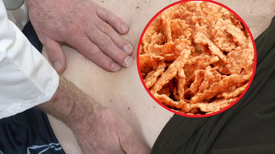 51-latek miał problemy z wątrobą. Okazało się, że jadł za dużo płatków śniadaniowych