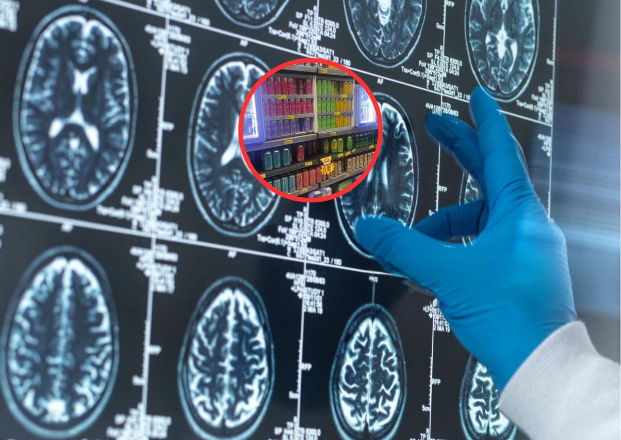 Udar po nadużywaniu popularnego napoju. Lekarze opisują przypadek