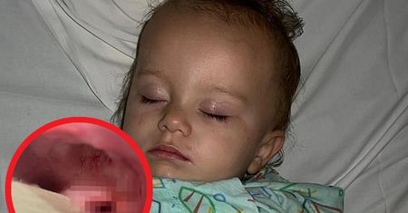 Ratowniczka ostrzega przed szczoteczami do zębów. "Z ust ciekła krew"