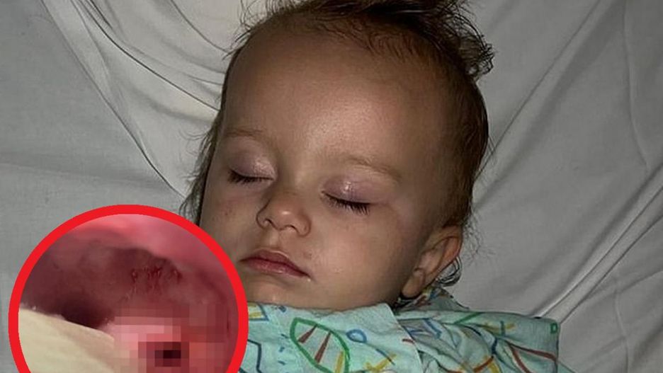 Myła zęby. Szczoteczka wbiła jej się w gardło. "Z ust ciekła krew"