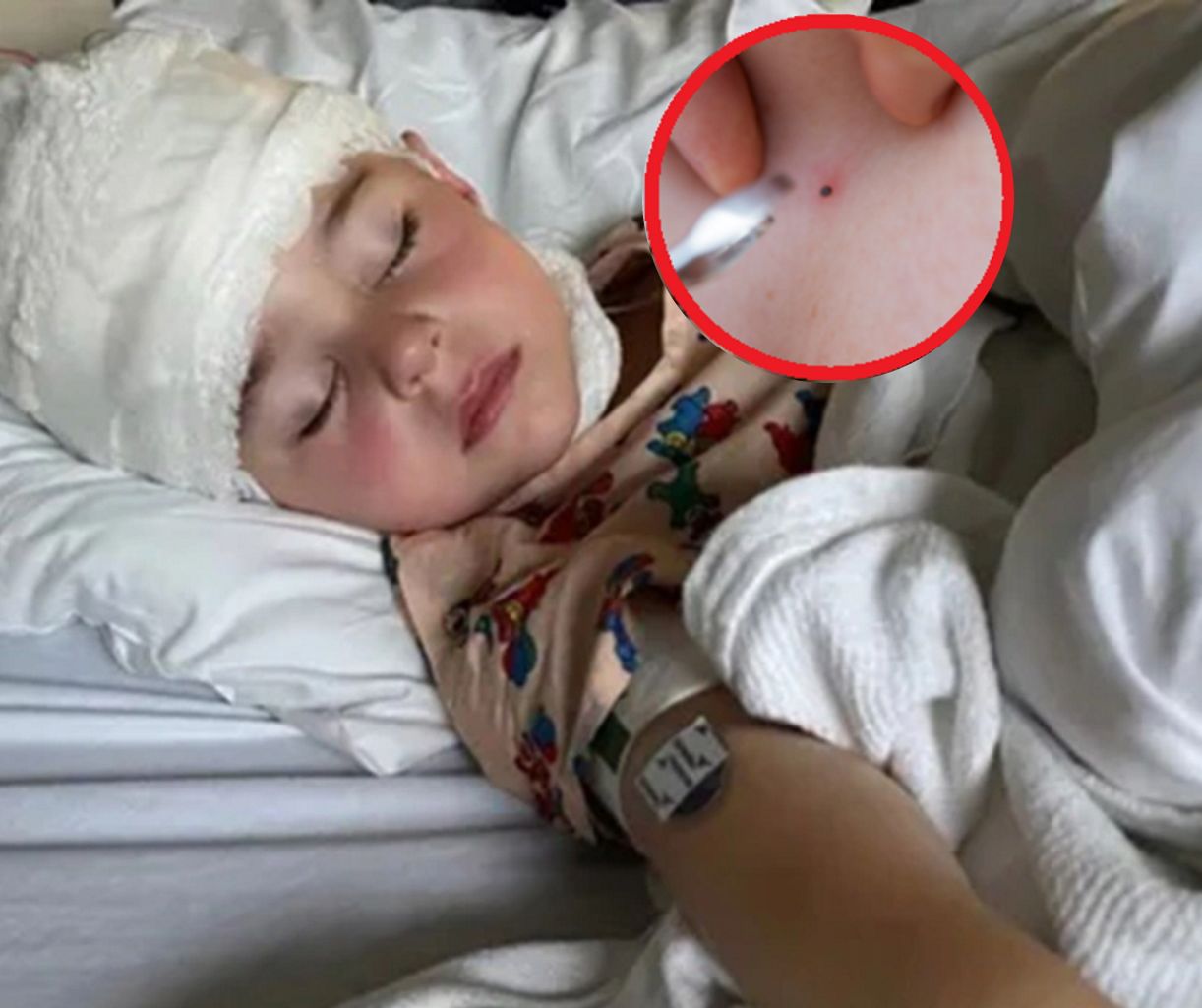 Dwa tygodnie po ukąszeniu przez kleszcza walczył o życie w szpitalu