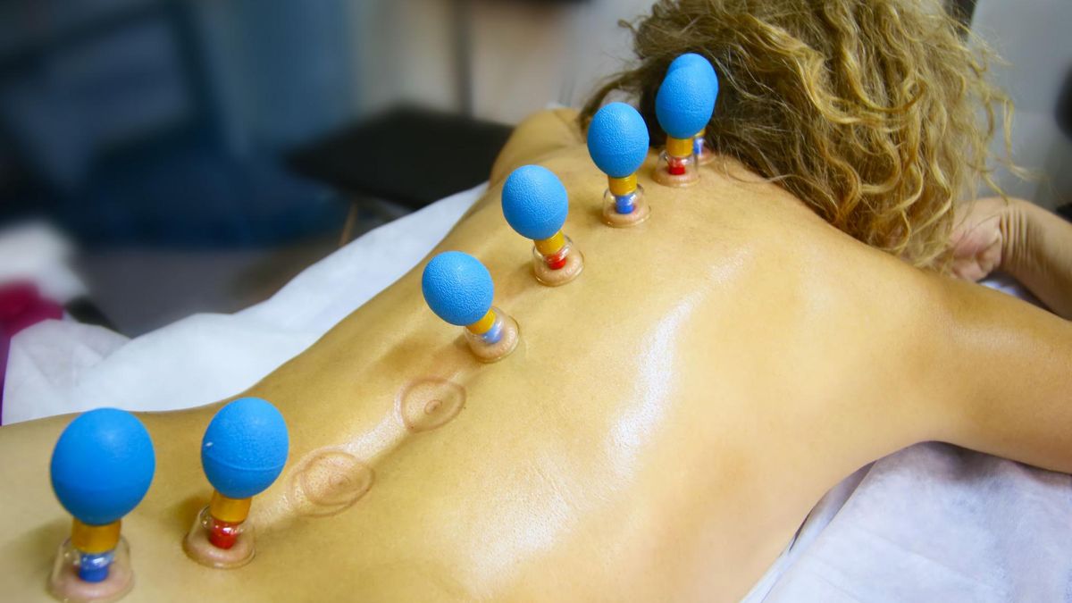 Stawianie baniek może pomóc w leczeniu przeziębienia czy astmy