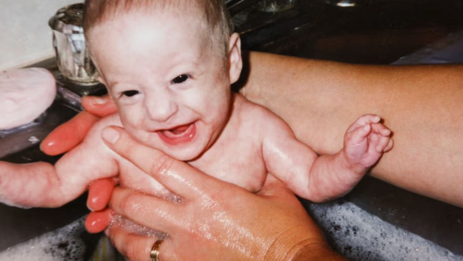 Przez większość swego życia, Hannah doświadczała niewłaściwych i złośliwych komentarzy ze strony swoich rówieśników