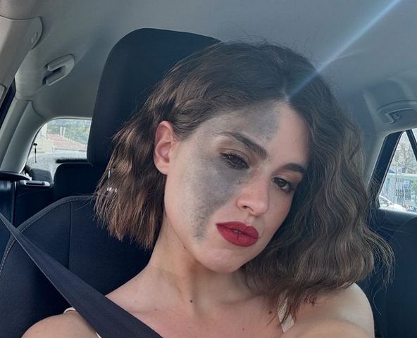 Carlotta ukrywała w dzieciństwie znamię