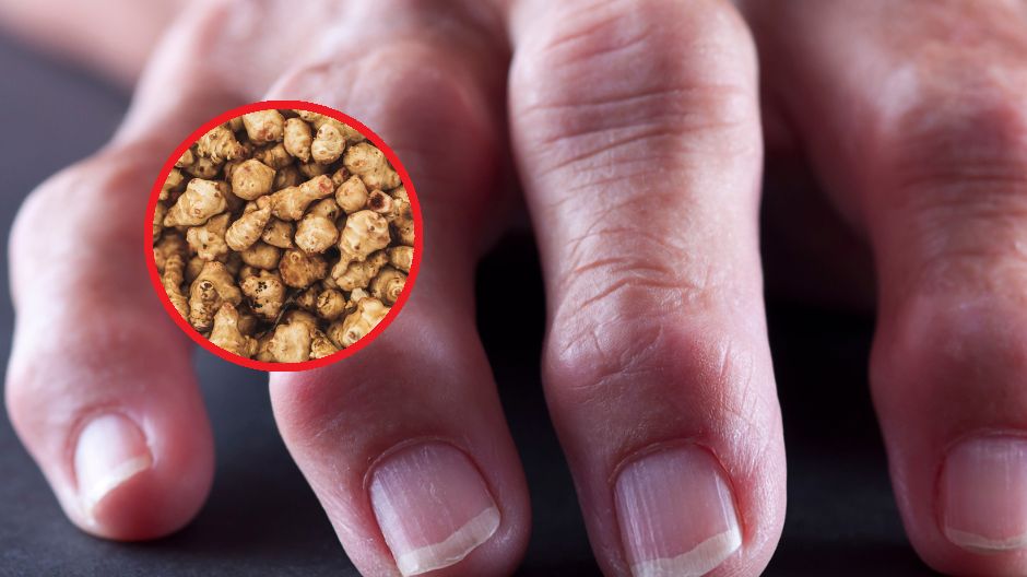 Dieta przeciwzapalna. Te produkty mogą uchronić przed zapaleniem stawów