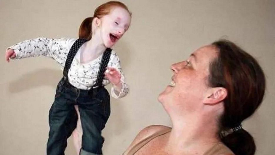 "Najmniejsza dziewczynka świata"