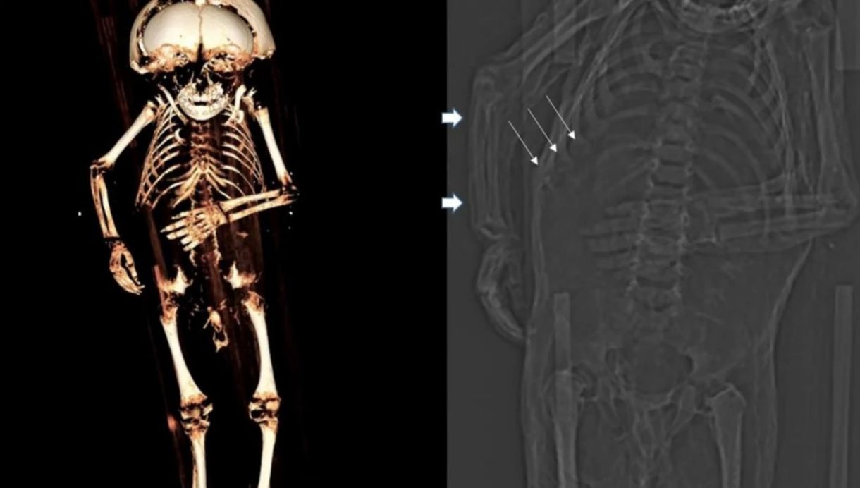 Przeprowadzono &quot;wirtualną autopsję&quot;