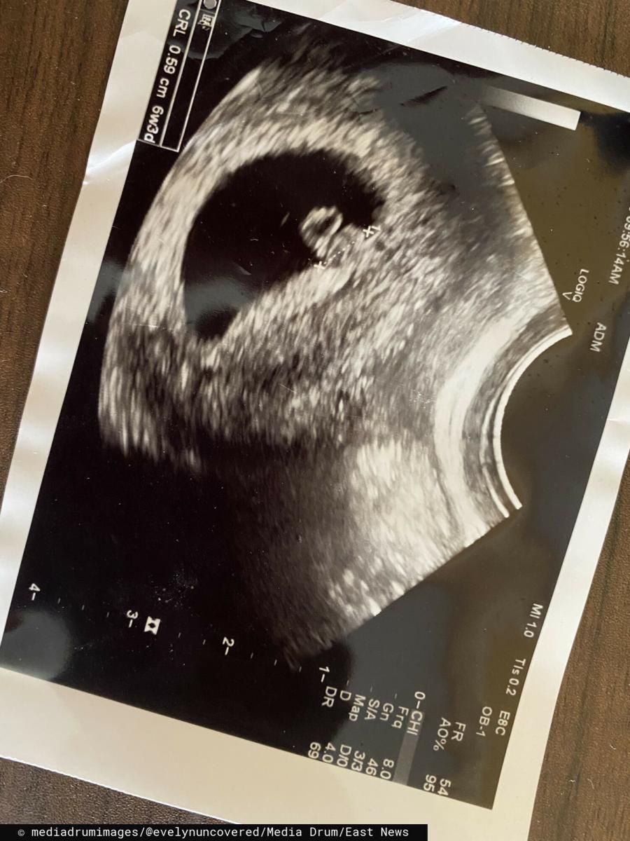 Nie podejrzewała, że uda jej się zajść w ciążę