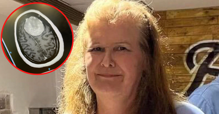 Była zmęczona i zapominała słów. Diagnoza ją zaskoczyła