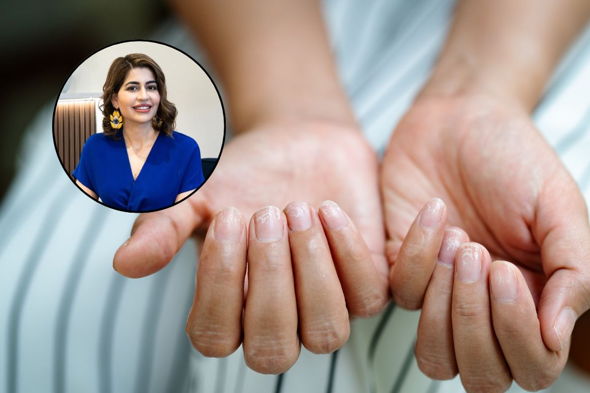 Mogą świadczyć o osteoporozie. Zwróć uwagę na 5 objawów