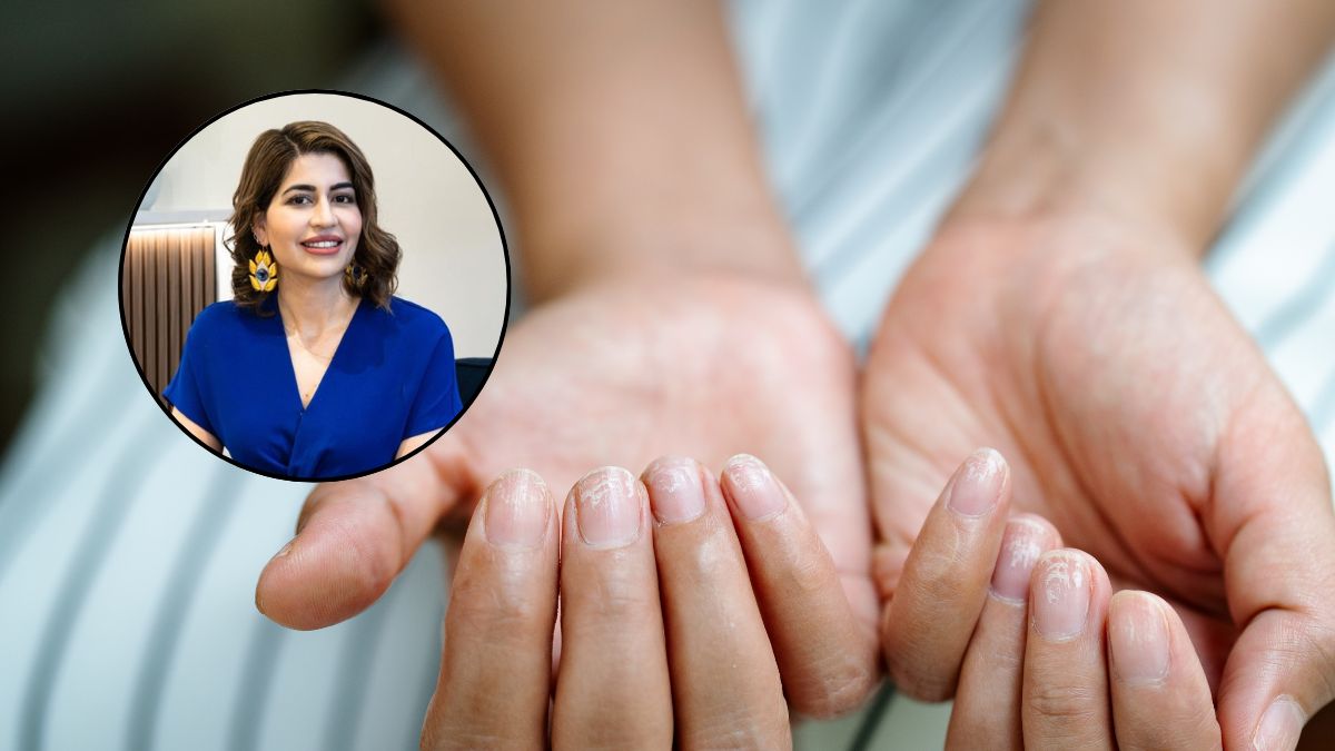 Lekarka wyjaśnia, jakie sygnały mogą świadczyć o osteoporozie