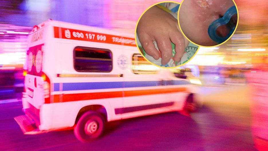 Myśleli, że to ospa. Dziecku usunięto fragmenty skóry