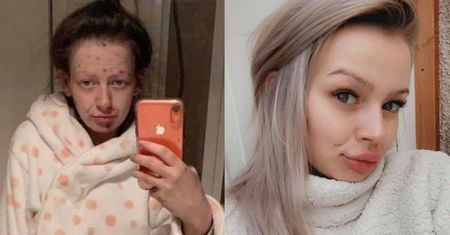 Metamorfoza byłej narkomanki. Kobieta pokazała swoje zdjęcia sprzed i po odwyku